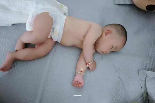 安丘宝宝褶皱处擦粉还是油
